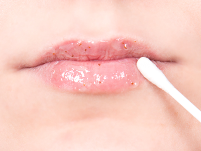 peeling labial