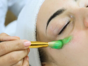 gel-cromatico--300x225 TRATAMIENTOS ANTIOJERAS Y BOLSAS