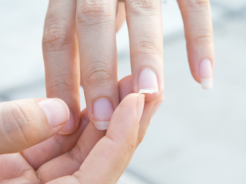 Los 5 signos en las uñas de que tienes una deficiencia de vitaminas desde  manchas blancas hasta surcos  Terra Chile